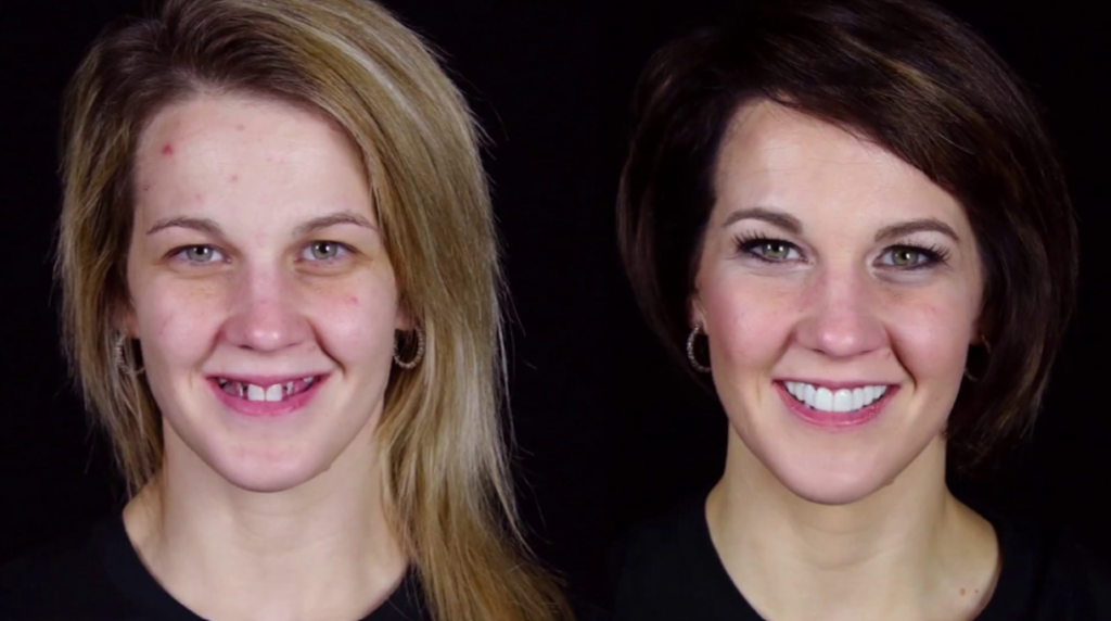 Smile Makeovers Manchester
